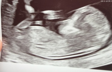 Gender guesses please 🙏 🩷💙