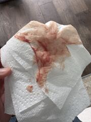 Attending triage too much? *trigger warning pictures*