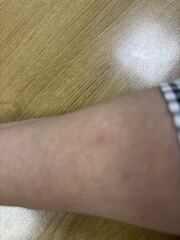 Weird skin mark