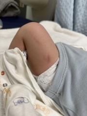 Accused of harming my baby while doctors investigate high calcium levels