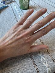 My hands age me!