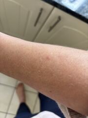 Weird skin mark