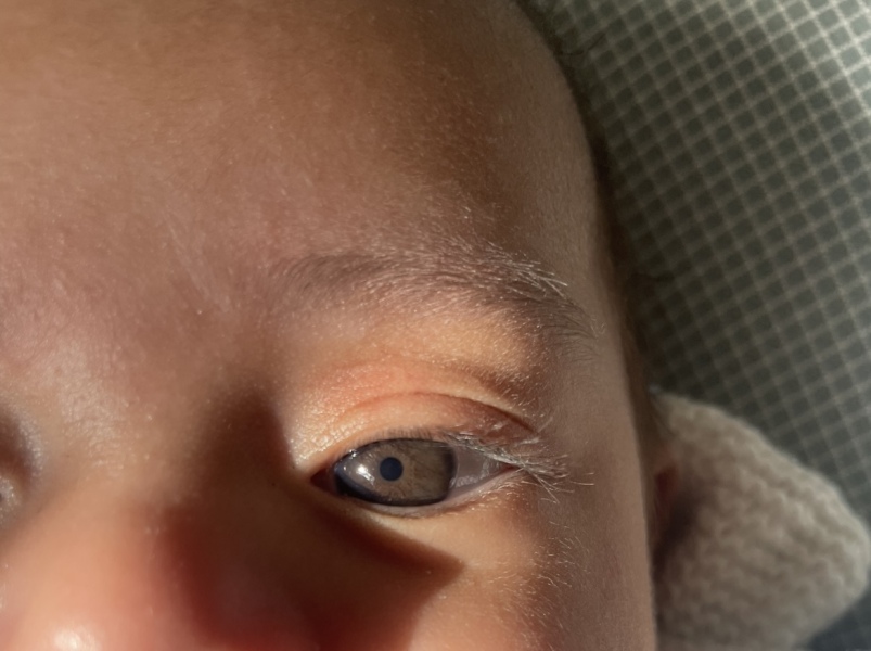 Does my baby appear to be developing green/brown eyes?