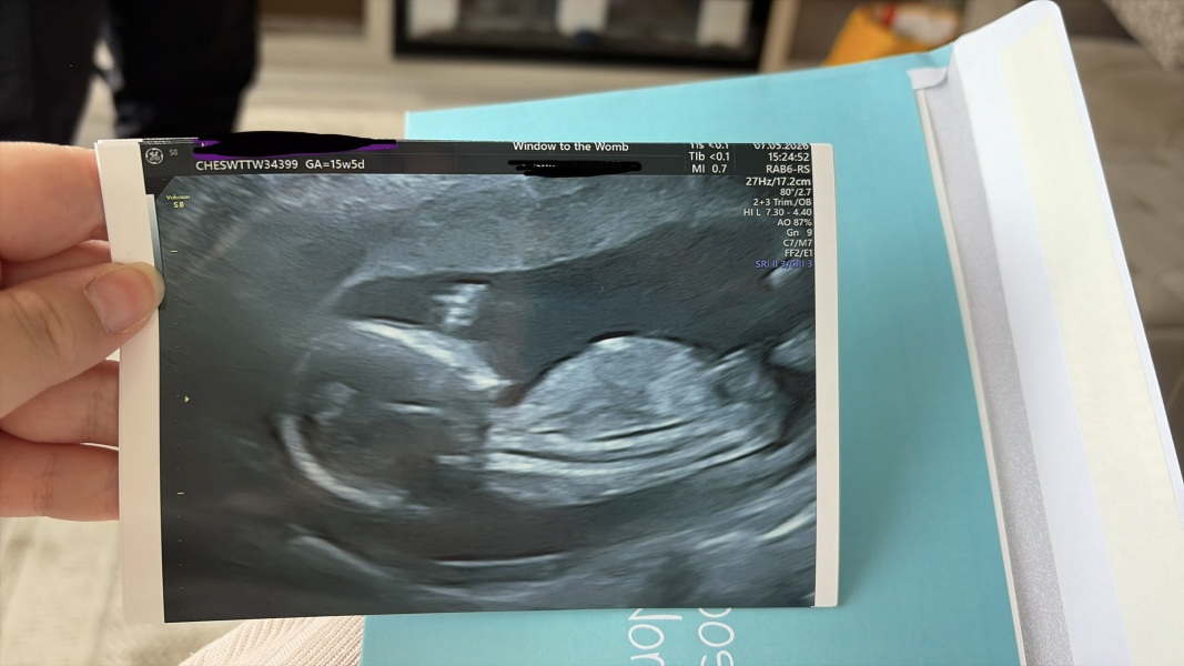 Nub theory - gender confirmed!