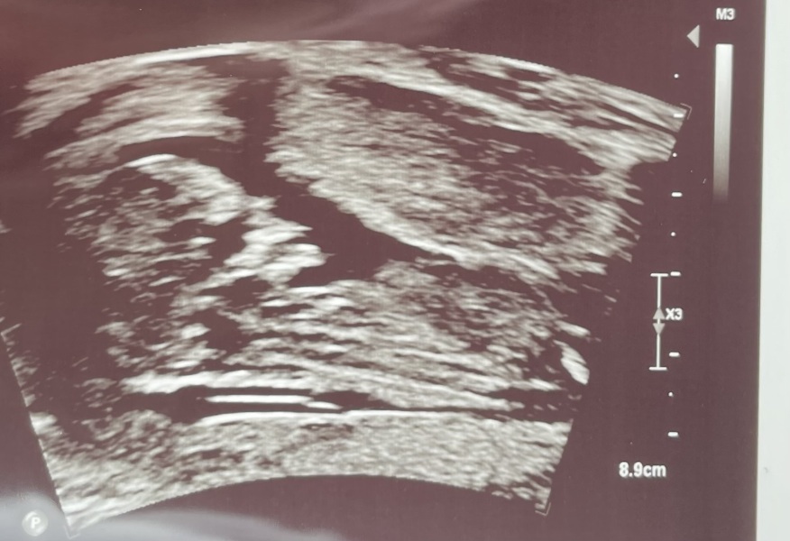 Any guesses on my baby's sex before I find out?