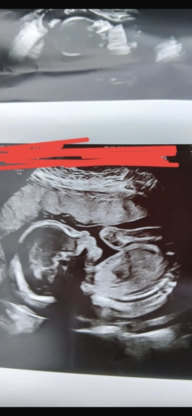 Boy or girl?
