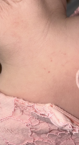 So scared about possible leukemia?