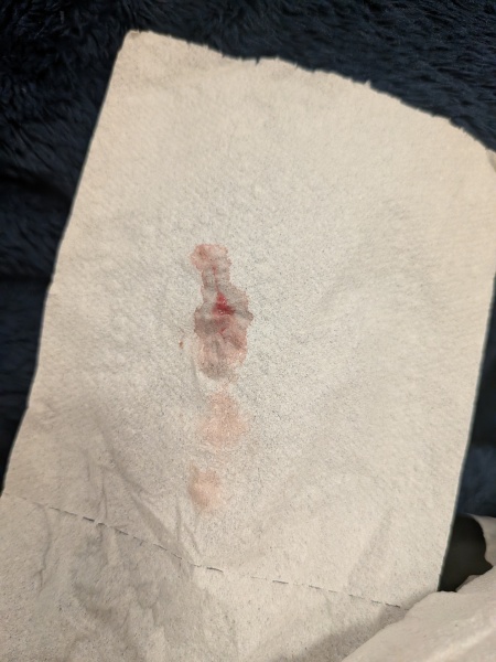 7dpo implantation bleeding or start of AF