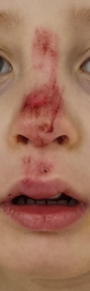 Would you get this checked out after a fall?