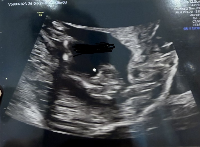 Has anyone been told the wrong sex at a 16 week scan?