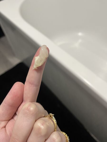 22 weeks pregnant and +++ protein in urine as well as pain