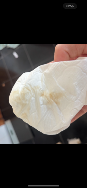 Does this look like implantation bleeding?