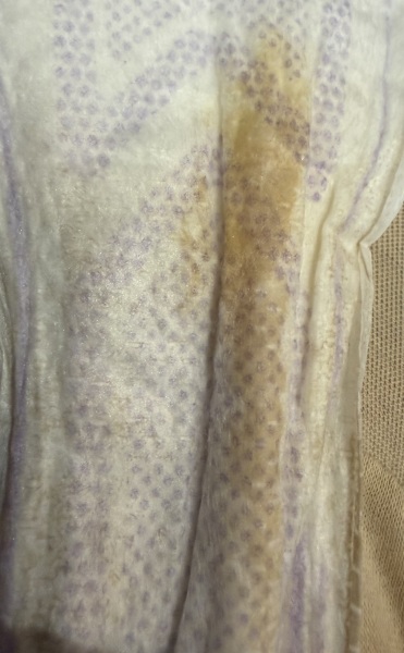 37 weeks yellow/brown discharge *TMI pic*