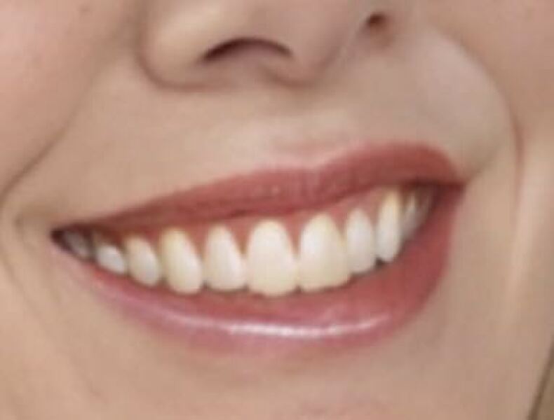 Very pale lips