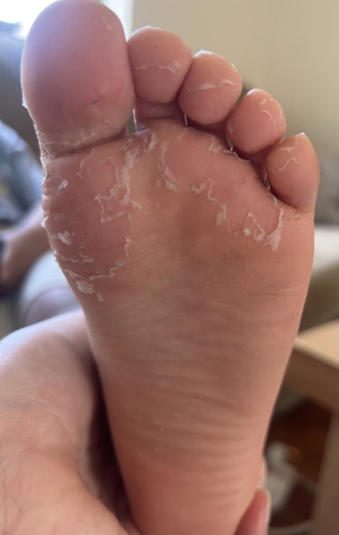 Advice for my 5 year olds feet!