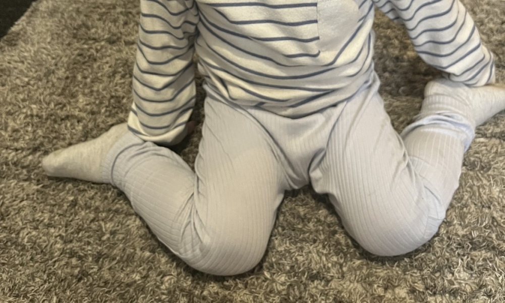 Very clumsy 26mo-Hypermobility?
