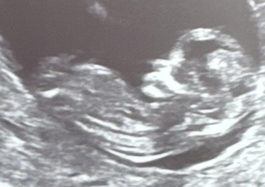 12 weeks 3 days. Boy or girl?