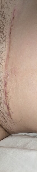 10 weeks pp - warning photo