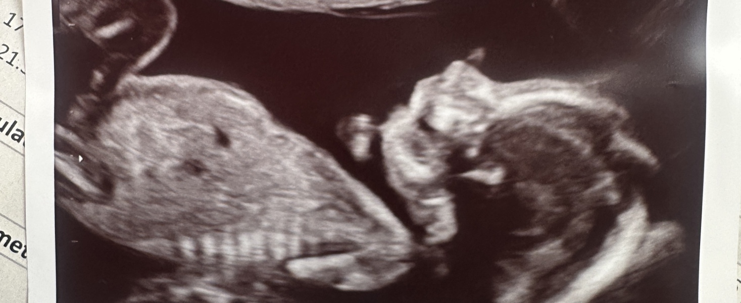 Is this a cord or boy bits?!