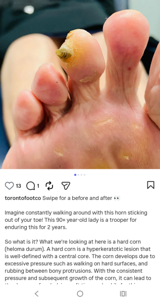 Has anyone seen this before? 🤢
