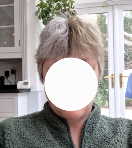 Should I dye my regrown hair or embrace the grey?