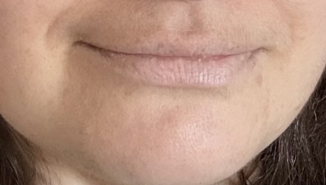 Very pale lips