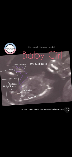Early pregnancy scan suggesting a girl, any positive experiences?