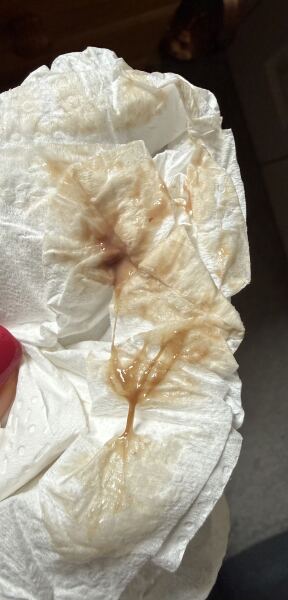 6 weeks pregnant - Brown bleeding