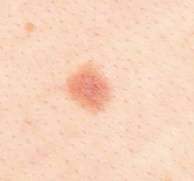 Mole help