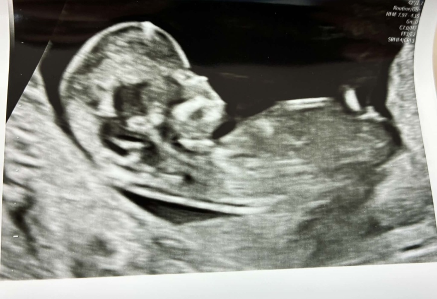 Does anyone have any gender predictions please?