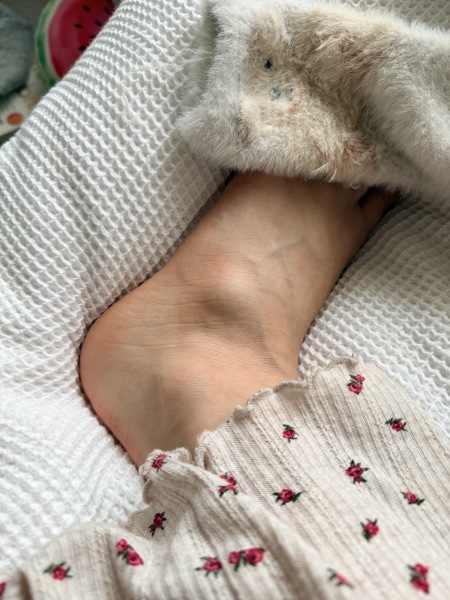 Lump and pain after ridiculous foot injury - need X-ray opinions!