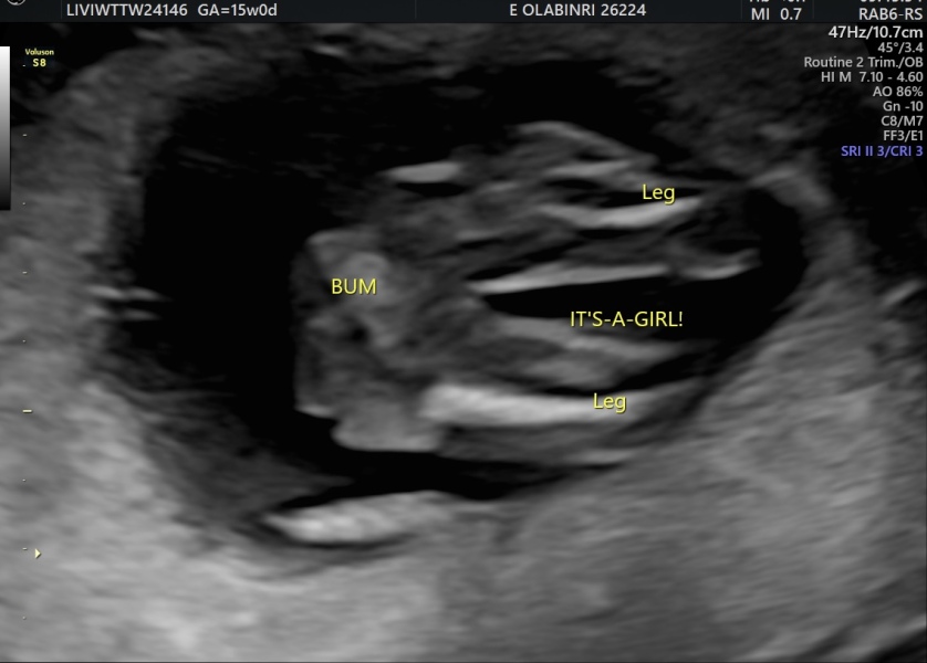 Pregnant with my third, any guesses on baby's sex tomorrow?