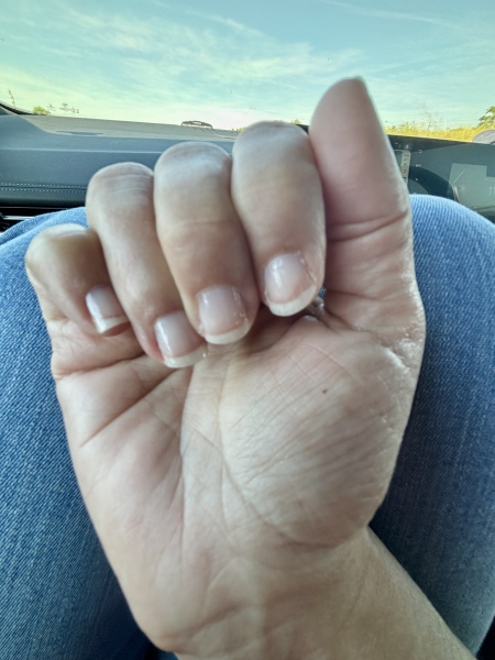 How can I stop my nails flaking?