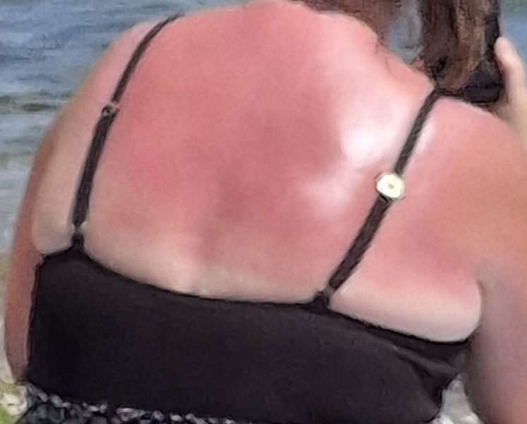 You can ban ONE summer look. Which?