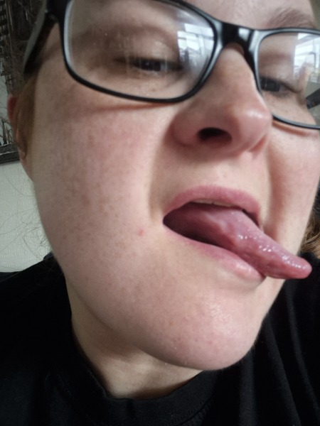 Worried about mouth cancer