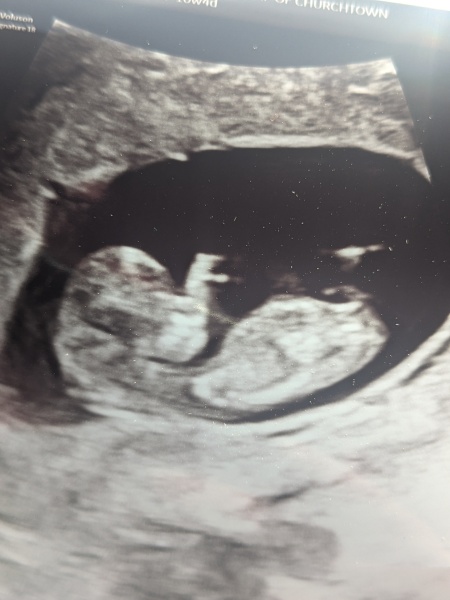 Due December 2026 (part 2)