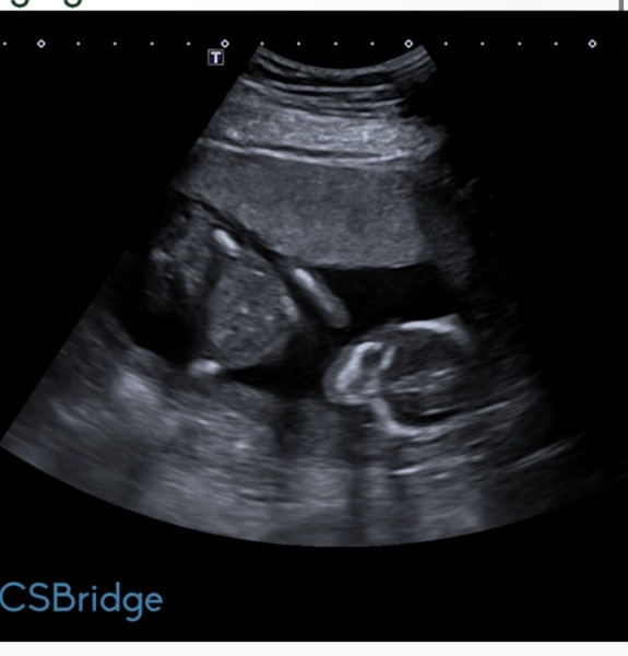 Any guesses on my baby's sex before I find out?