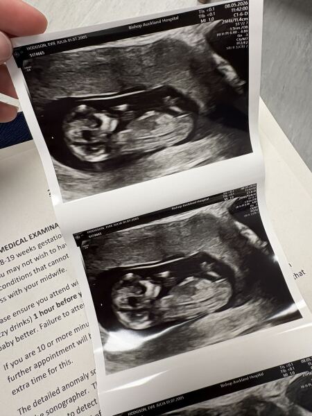 Boy or girl ?