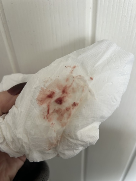 Clumpy spotting 3 days before period, 10 days post ovulation