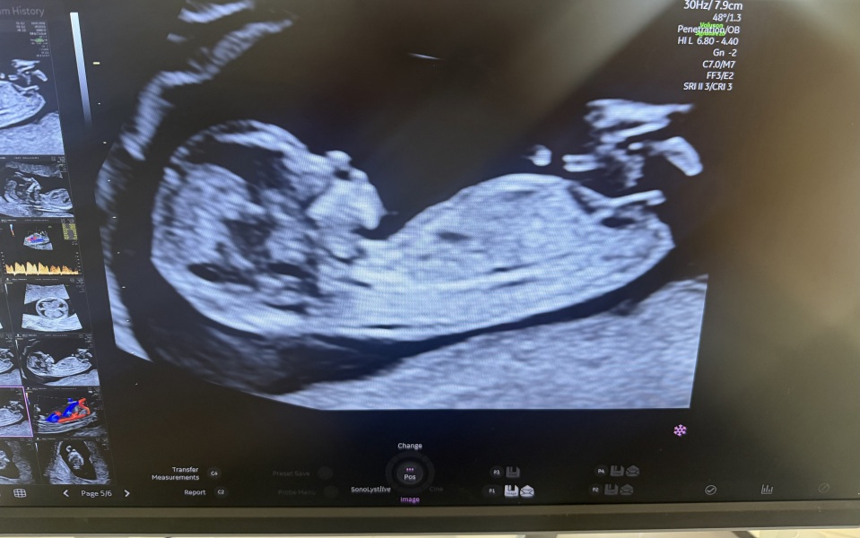 Boy or girl do you think? 🥰