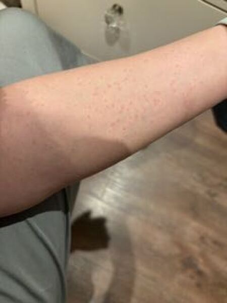 Strange rash - any ideas?