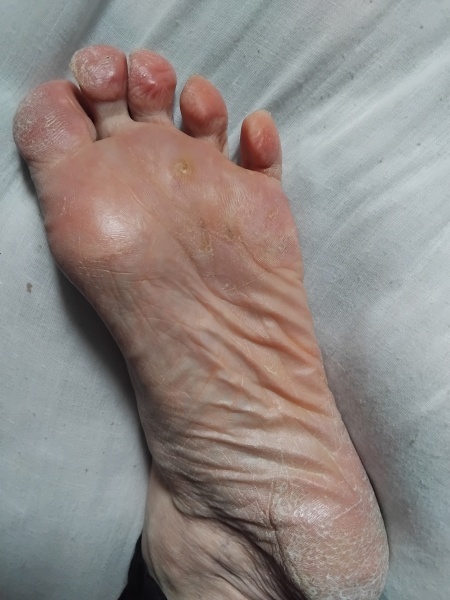 Could this be diabetes (symptoms and pictures attached)?