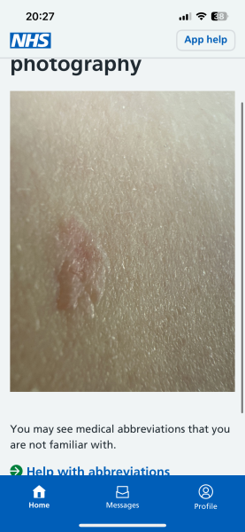 2WW referral, does this look like cancer?