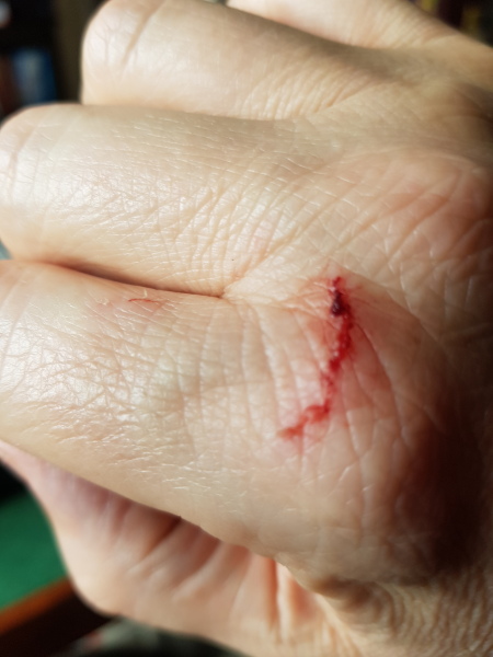 What to do about local aggressive cat.