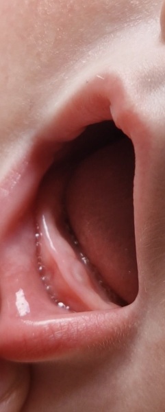 is this teething???