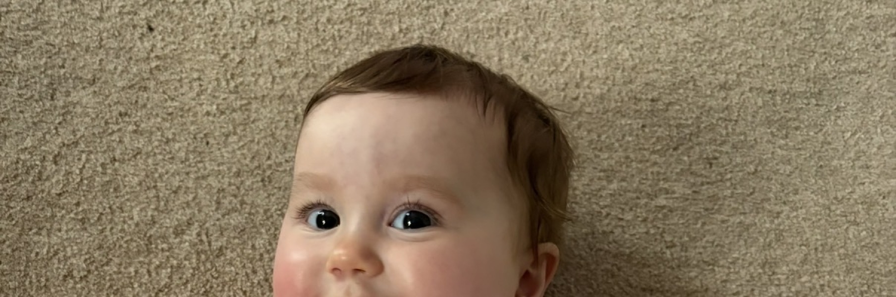 Should I be worried about my 8 month old's eyebrows?
