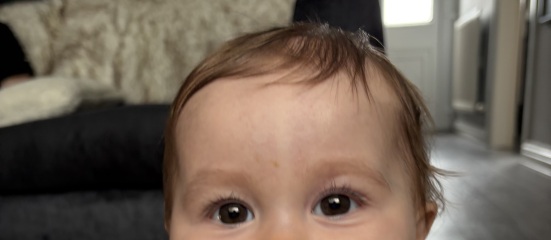 Anyone else’s little one have particularly bushy eyebrows?