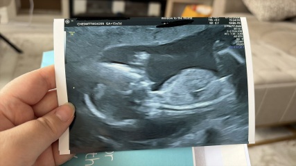 Nub theory - gender confirmed!