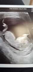 Boy or Girl?