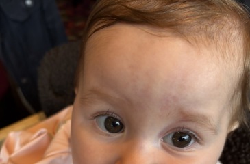 Should I be worried about my 8 month old's eyebrows?